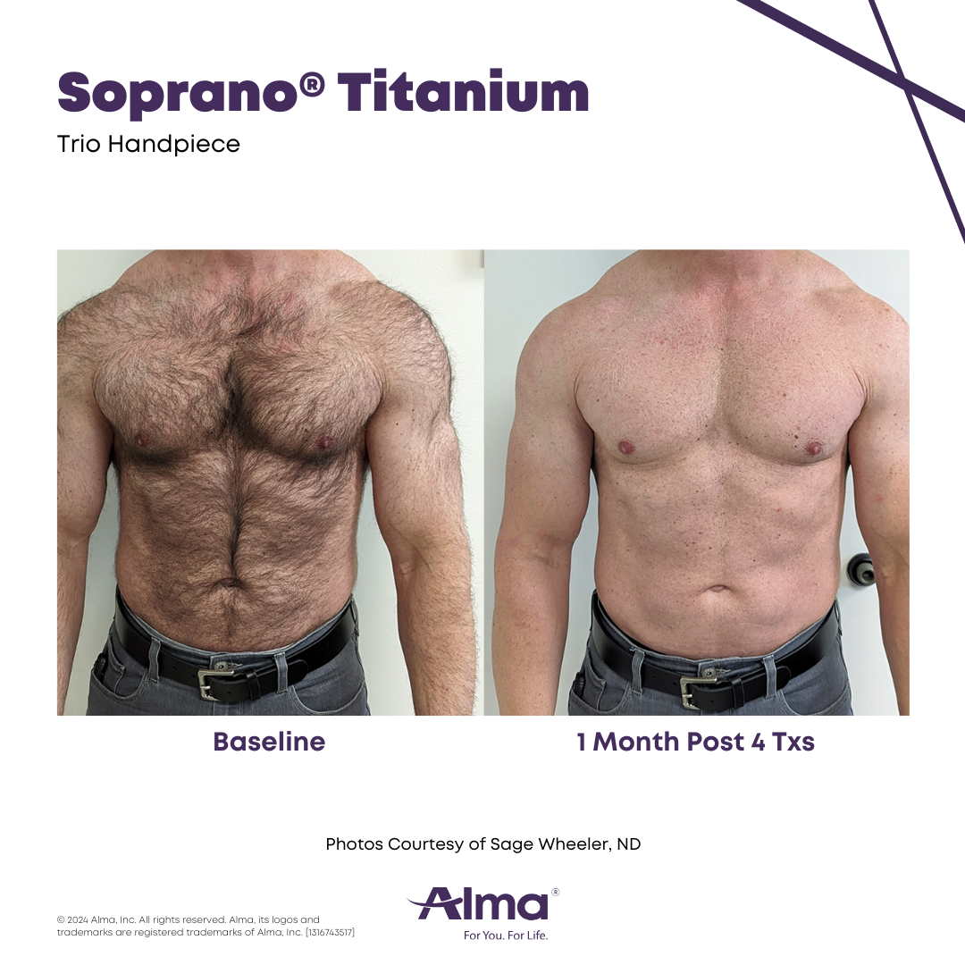 mediaManagerImageAlmaSoprano3